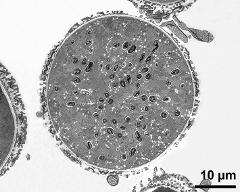 pollen grain in cross section