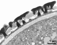 pollen wall; interapertural area