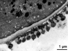 pollen wall, transition from aperture to interapertural area