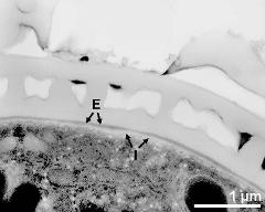 interapertural area of pollen wall