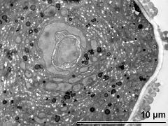 vegetative nucleus and generative cell