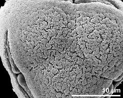 exine surface at the distal end of the tetrad ("bottom")