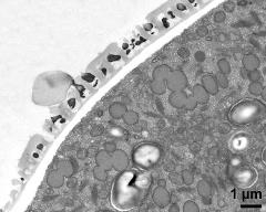 pollen wall at transition of aperture and interapertural area