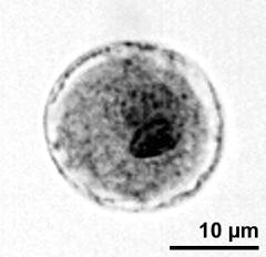 generative cell and vegetative nucleus (dark stained)