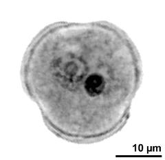 generative cell (dark) and vegetative nucleus