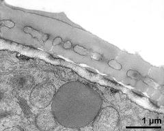 pollen wall, interapertural area