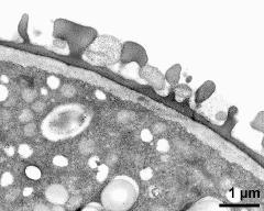 pollen wall; interapertural area