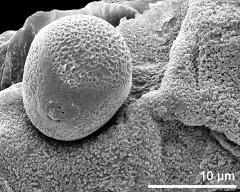 locular wall with Ubisch bodies and pollen grain (oblique view)