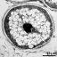 generative cell (right) and vegetative nucleus (left, dark); note starch grains (white)