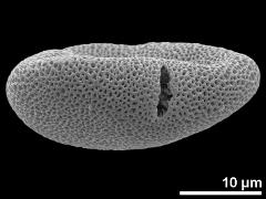 acetolyzed pollen,equatorial view