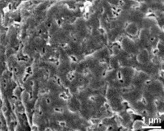 exine surface of hydrated tetrad