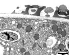 pollen wall at transition of aperture and interapertural area