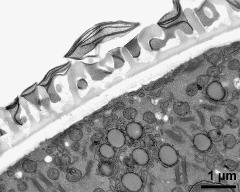 pollen wall; interapertural area