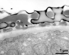 interapertural area of pollen wall