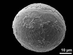 distal polar view