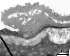 pollen wall at transition of aperture and interapertural area