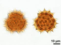 acetolyzed pollen,polar view