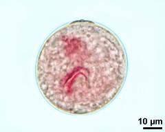 vegetative nucleus and two sperm cells