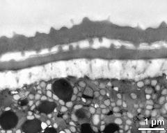 interapertural area of pollen wall