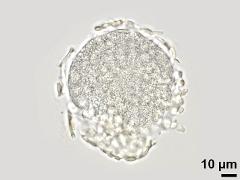 acetolyzed pollen