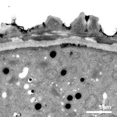 detail of aperture with ornamented colpus membrane