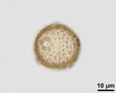 acetolysed pollen, upper focus