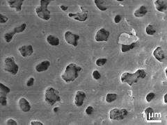 acetolyzed pollen,exine surface