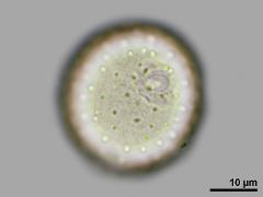 equatorial view,hydrated pollen