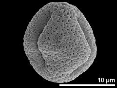 Equatorial view showing two apertures