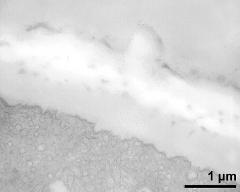 apertural area of pollen wall