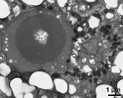 vegetative nucleus and generative cell