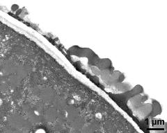 pollen wall at transition of aperture and interapertural area