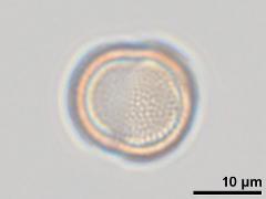 equatorial view,acetolyzed pollen