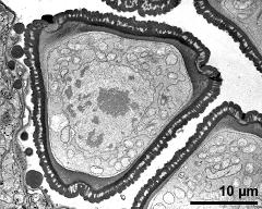 microspore; note lipid plug at the apertur (up left)