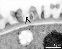 interapertural area of pollen wall