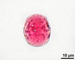 pollen grain with sperm cells (asterisks)