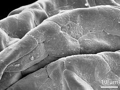 tetrads (forming pollinium)