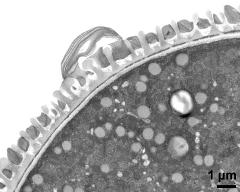 pollen wall; interapertural area