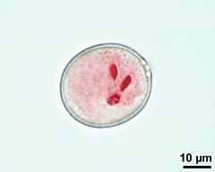 vegetative nucleus and sperm cells