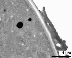 pollen wall at transition of aperture and interapertural area