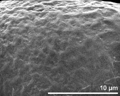 exine surface (equatorial area)