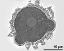 pollen grain in cross section