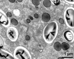 vegetative cytoplasm with organells