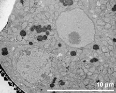 generative cell (left) and vegetative nucleus (right)