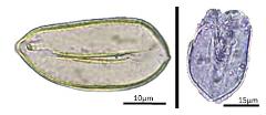 acetolyzed pollen,equatorial view,polar view