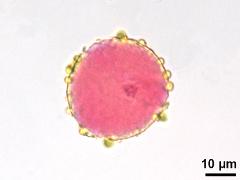 generative cell,pollenkitt,polar view