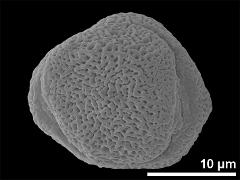 Equatorial view showing two apertures