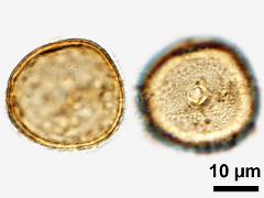 acetolyzed pollen,polar view