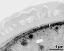 interapertural area of pollen wall, intine (I), endexine (E)