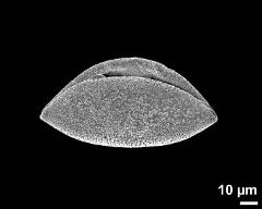 dry pollen grain in equatorial view